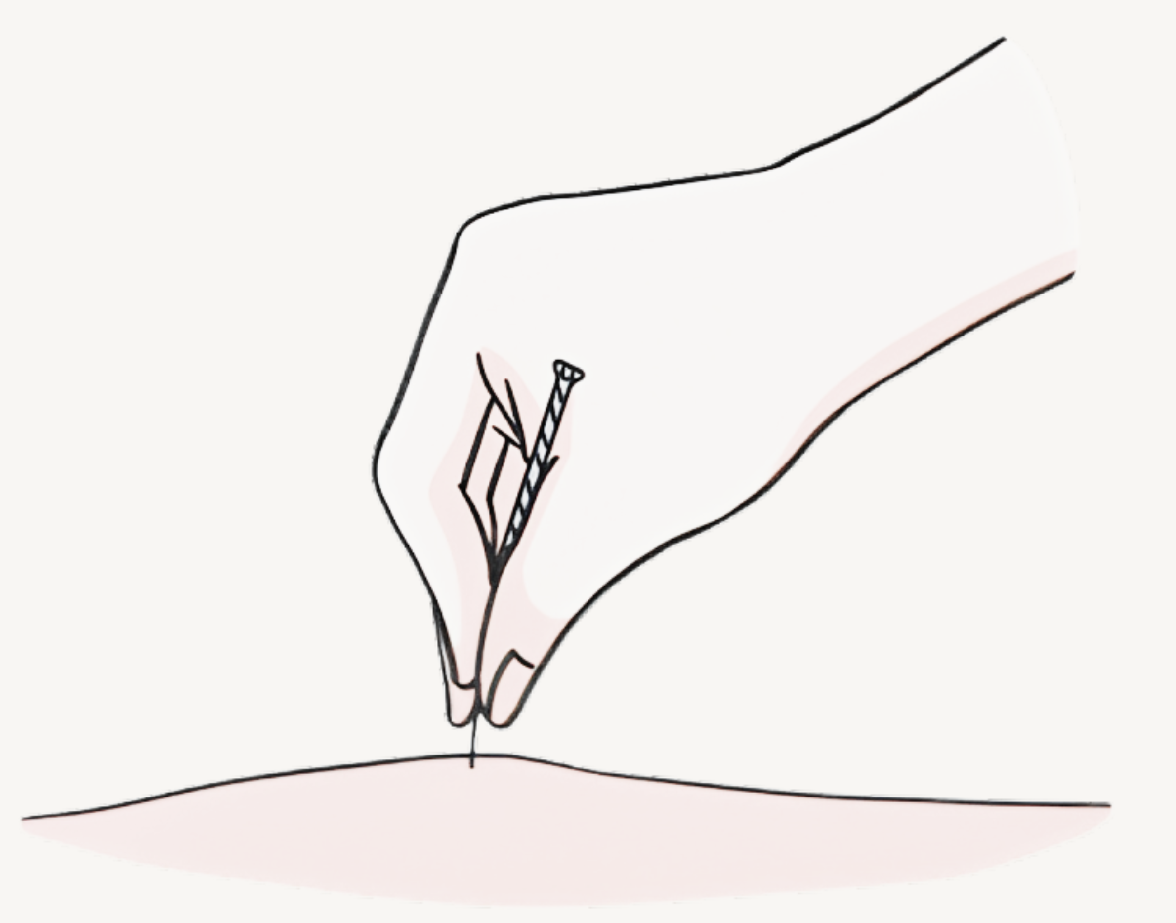 Exploring the Power of Acupuncture: Ancient Techniques for Modern Pain Relief