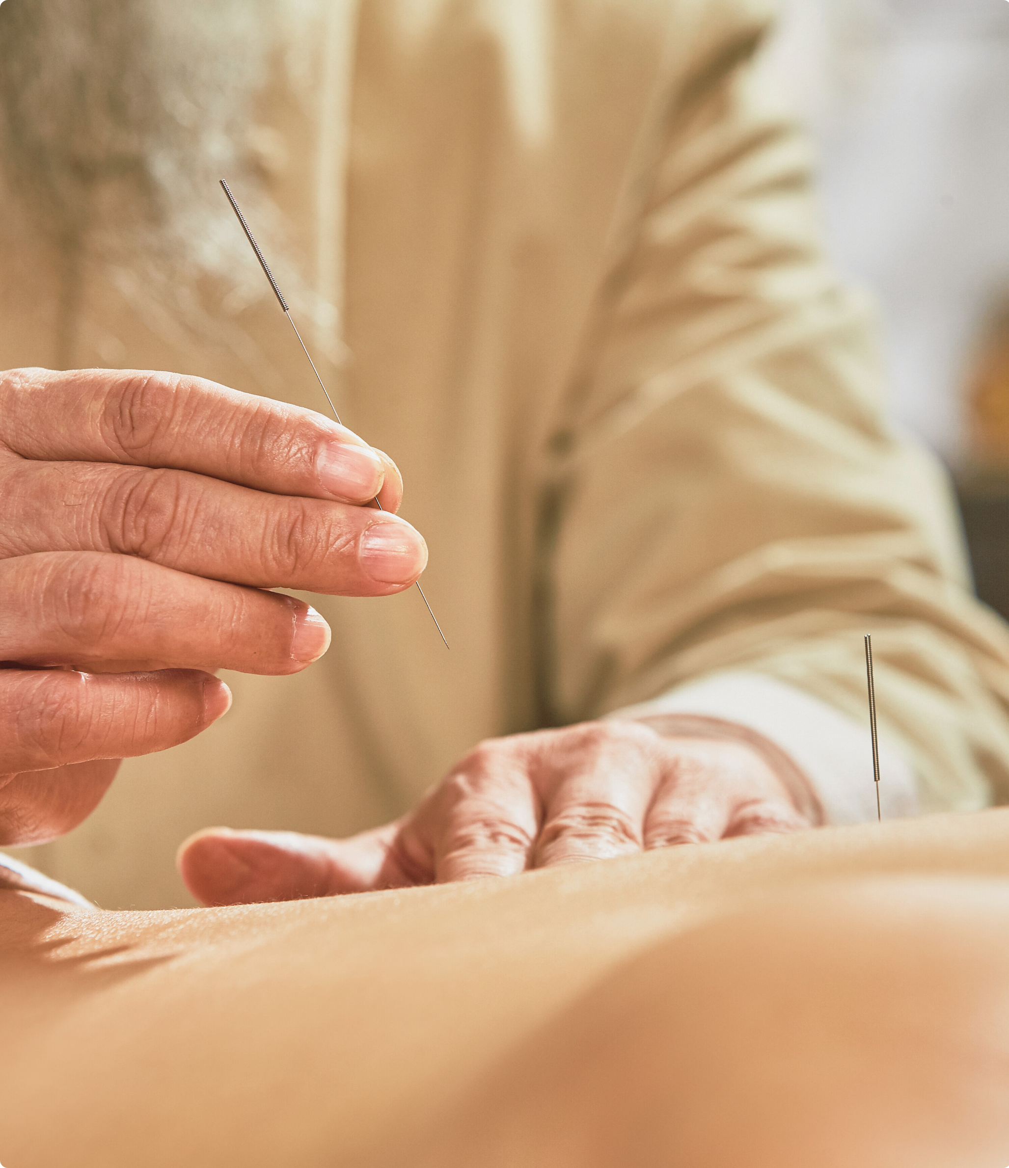 Welcome to AcuVeda- A Journey Back to Tradition